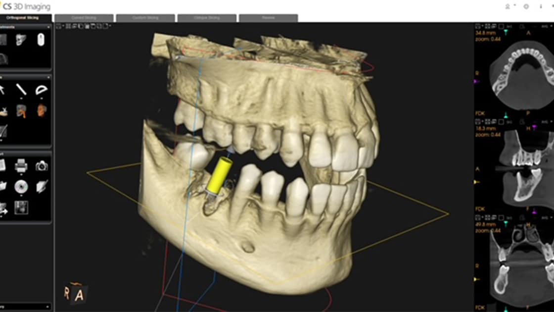 Anatomage Implant Surgery Software Systems and Digital and 3D Imaging Technology