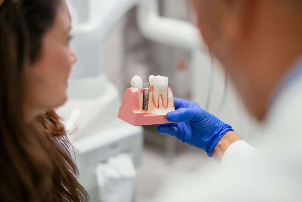 Dental Implants vs. Bridges: Pros, Cons & Best Choice
