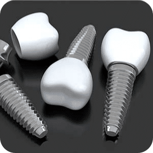 Dental Implants Image